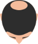 Mild to Large